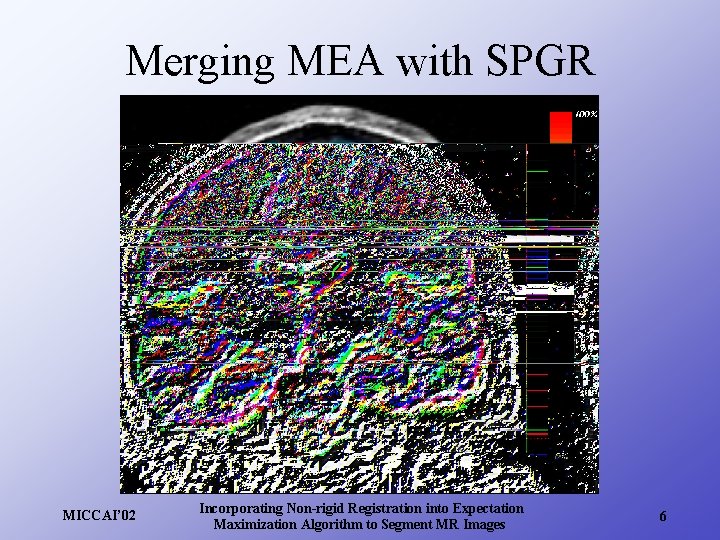 Merging MEA with SPGR MICCAI’ 02 Incorporating Non-rigid Registration into Expectation Maximization Algorithm to