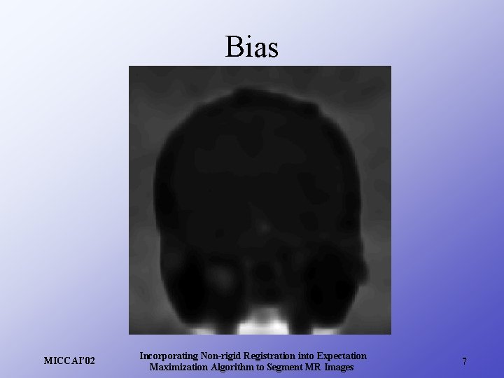 Bias MICCAI’ 02 Incorporating Non-rigid Registration into Expectation Maximization Algorithm to Segment MR Images