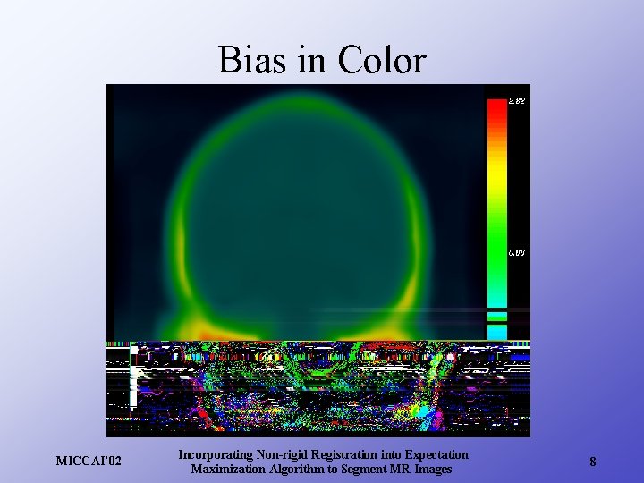 Bias in Color MICCAI’ 02 Incorporating Non-rigid Registration into Expectation Maximization Algorithm to Segment