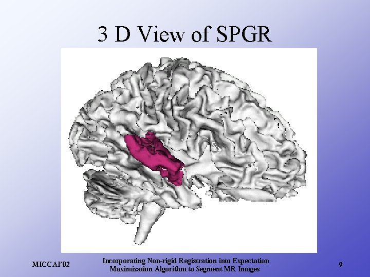 3 D View of SPGR MICCAI’ 02 Incorporating Non-rigid Registration into Expectation Maximization Algorithm