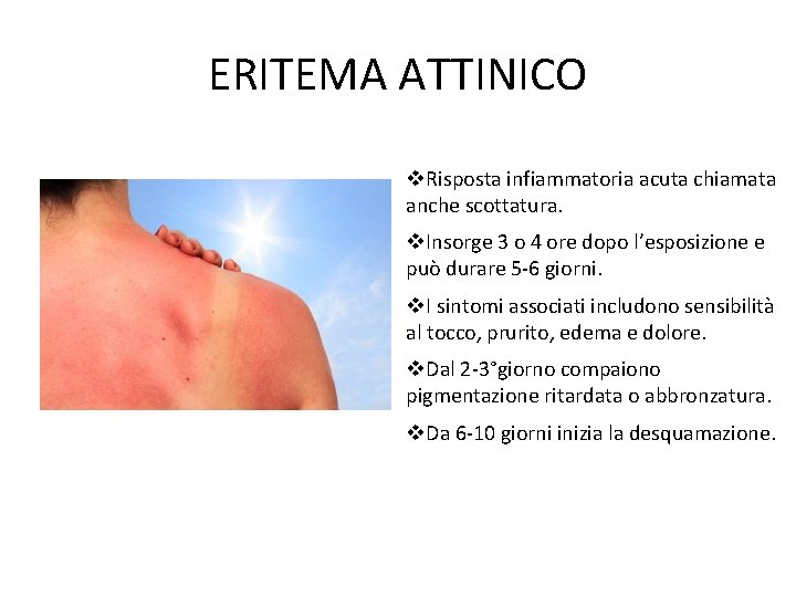 ERITEMA ATTINICO Risposta infiammatoria acuta chiamata anche scottatura. Insorge 3 o 4 ore dopo