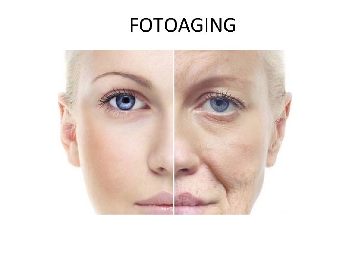 FOTOAGING 