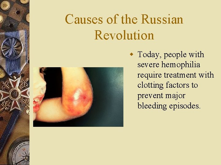 Causes of the Russian Revolution w Today, people with severe hemophilia require treatment with