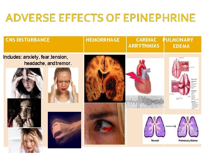 CNS DISTURBANCE Includes: anxiety, fear, tension, headache, and tremor. HEMORRHAGE CARDIAC PULMONARY ARRYTHMIA S