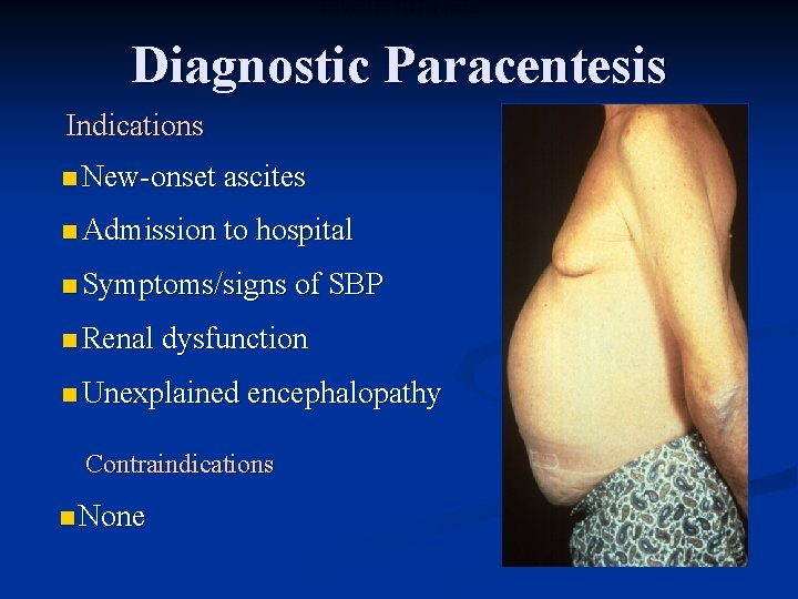 DIAGNOSTIC PARACENTESIS Diagnostic Paracentesis Indications n New-onset ascites n Admission to hospital n Symptoms/signs