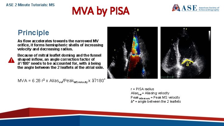 ASE 2 Minute Tutorials: MS MVA by PISA Principle As flow accelerates towards the