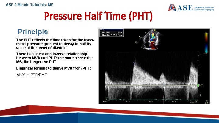 ASE 2 Minute Tutorials: MS Pressure Half Time (PHT) Principle The PHT reflects the