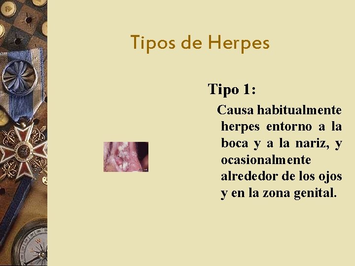 Tipos de Herpes Tipo 1: Causa habitualmente herpes entorno a la boca y a