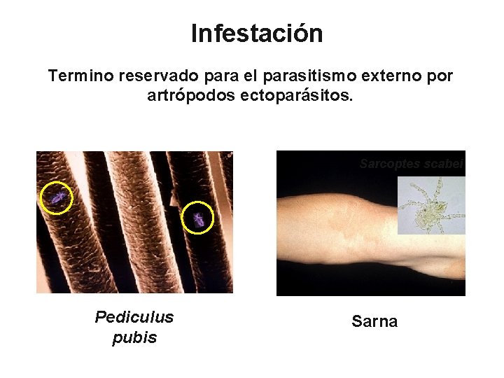 Infestación Termino reservado para el parasitismo externo por artrópodos ectoparásitos. Sarcoptes scabei Pediculus pubis