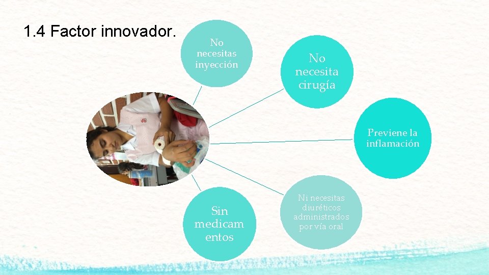 1. 4 Factor innovador. No necesitas inyección No necesita cirugía Previene la inflamación Sin
