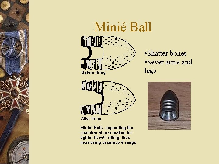 Minié Ball • Shatter bones • Sever arms and legs 