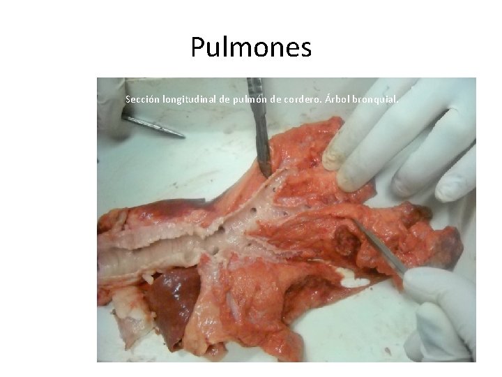 Pulmones Sección longitudinal de pulmón de cordero. Árbol bronquial. 