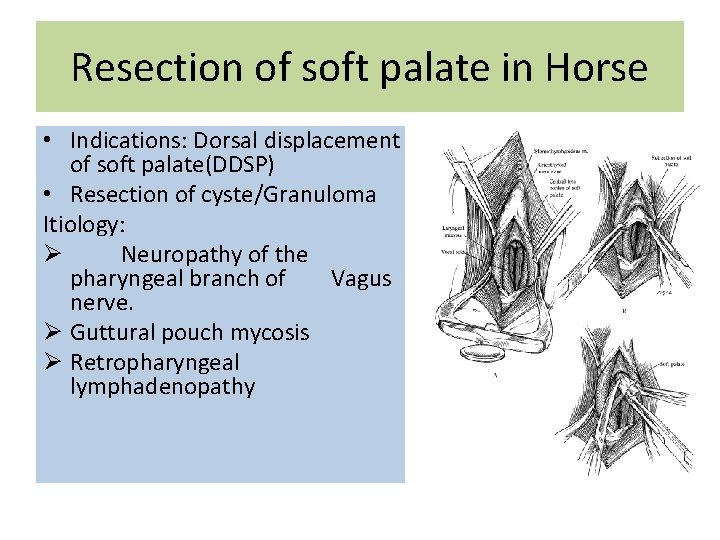 Resection of soft palate in Horse • Indications: Dorsal displacement of soft palate(DDSP) •