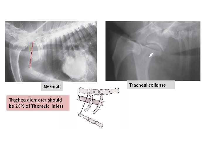 Normal Trachea diameter should be 20% of Thoracic inlets Tracheal collapse 