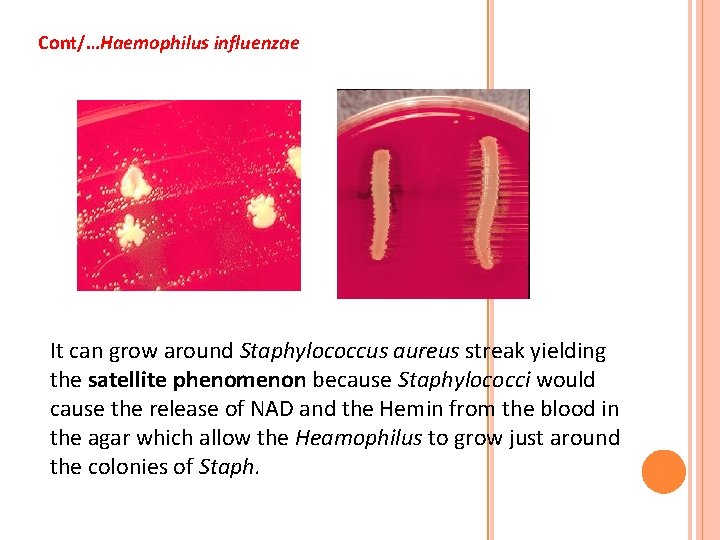 Cont/…Haemophilus influenzae It can grow around Staphylococcus aureus streak yielding the satellite phenomenon because