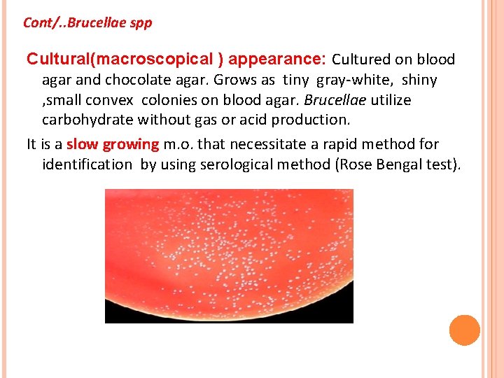 Cont/. . Brucellae spp Cultural(macroscopical ) appearance: Cultured on blood agar and chocolate agar.