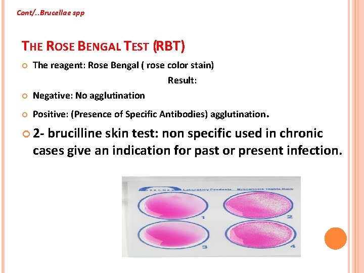 Cont/. . Brucellae spp THE ROSE BENGAL TEST (RBT) The reagent: Rose Bengal (