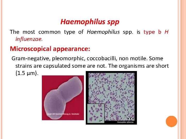 Haemophilus spp The most common type of Haemophilus spp. is type b H influenzae.