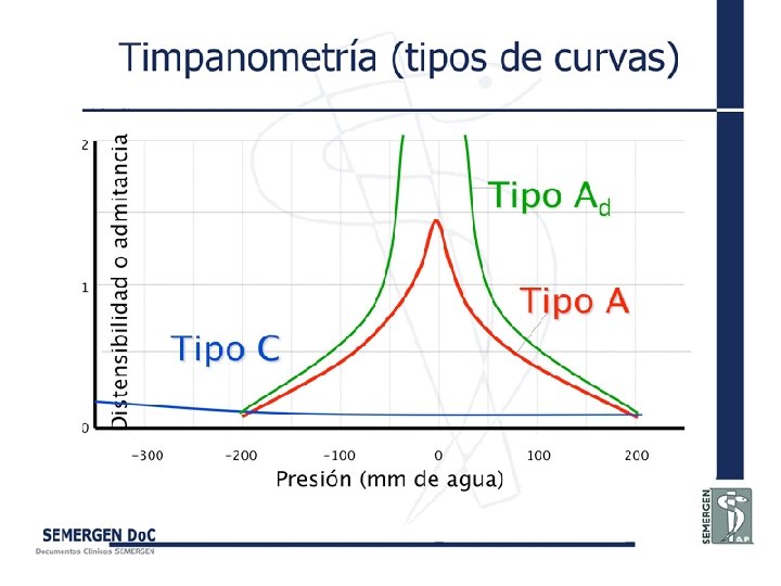 Timpanometría (tipos de curvas) 