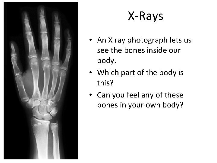 X-Rays • An X ray photograph lets us see the bones inside our body.