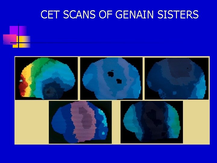 CET SCANS OF GENAIN SISTERS 