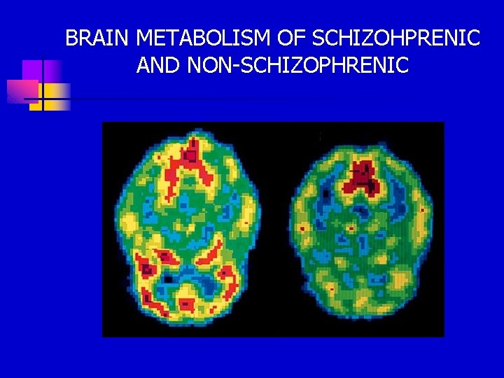 BRAIN METABOLISM OF SCHIZOHPRENIC AND NON-SCHIZOPHRENIC 