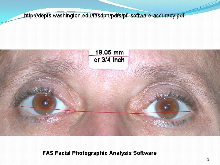 http: //depts. washington. edu/fasdpn/pdfs/pfl-software-accuracy. pdf FAS Facial Photographic Analysis Software 13 http: //depts. washington. edu/fasdpn/pdfs/pfl-software-accuracy. pdf FAS Facial Photographic Analysis Software 13