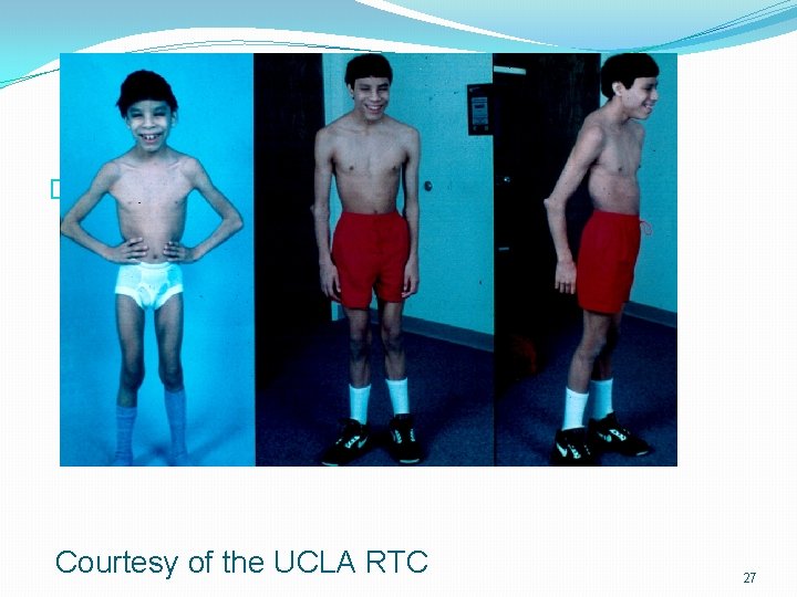 �UCLA Courtesy of the UCLA RTC 27 �UCLA Courtesy of the UCLA RTC 27