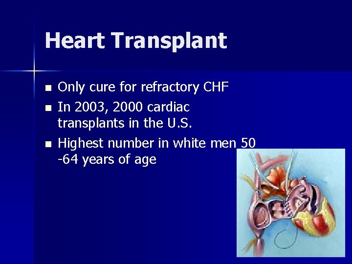 Heart Transplant n n n Only cure for refractory CHF In 2003, 2000 cardiac