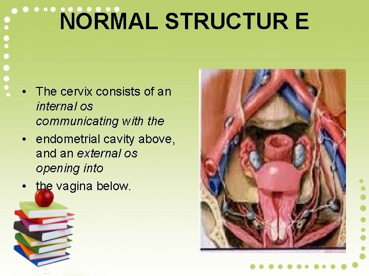 NORMAL STRUCTUR E • The cervix consists of an internal os communicating with the