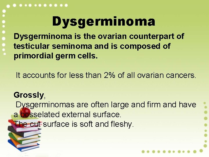 Dysgerminoma is the ovarian counterpart of testicular seminoma and is composed of primordial germ