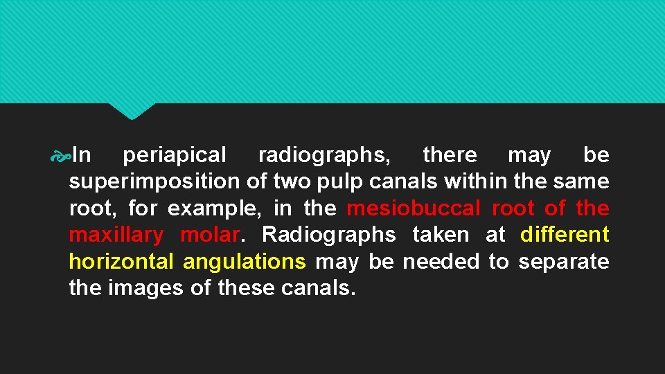  In periapical radiographs, there may be superimposition of two pulp canals within the