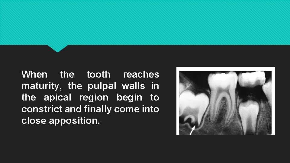When the tooth reaches maturity, the pulpal walls in the apical region begin to