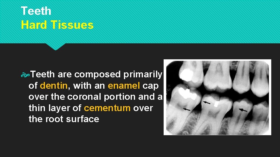 Teeth Hard Tissues Teeth are composed primarily of dentin, with an enamel cap over