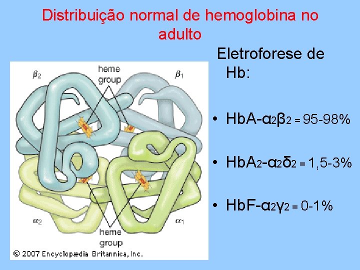 Distribuição normal de hemoglobina no adulto Eletroforese de Hb: • Hb. A-α 2β 2