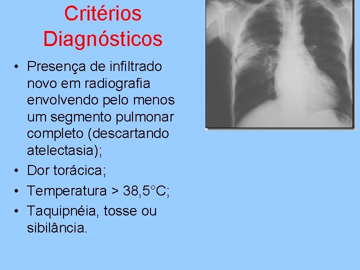 Critérios Diagnósticos • Presença de infiltrado novo em radiografia envolvendo pelo menos um segmento