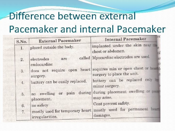 Difference between external Pacemaker and internal Pacemaker 