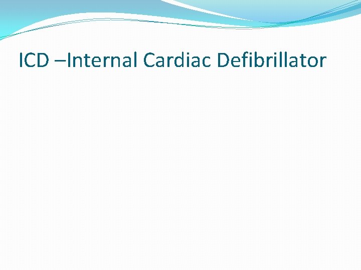 ICD –Internal Cardiac Defibrillator 