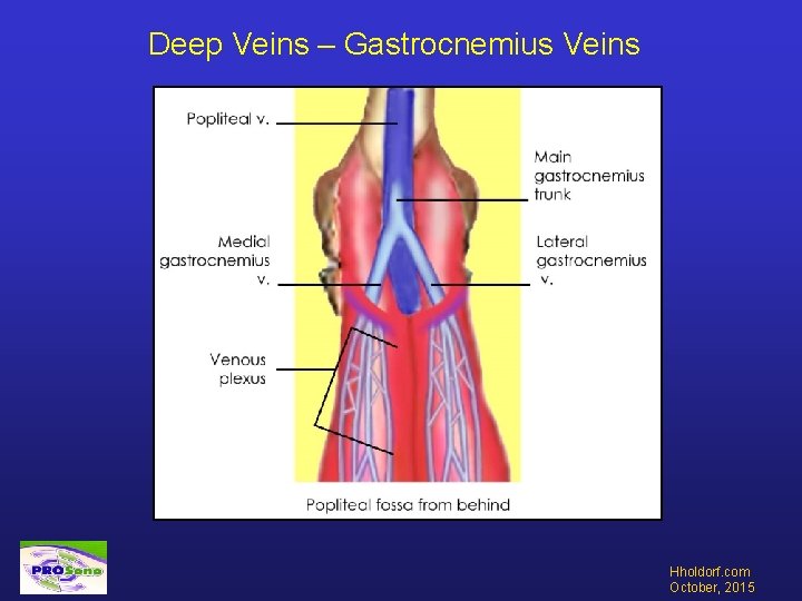 Deep Veins – Gastrocnemius Veins Hholdorf. com October, 2015 