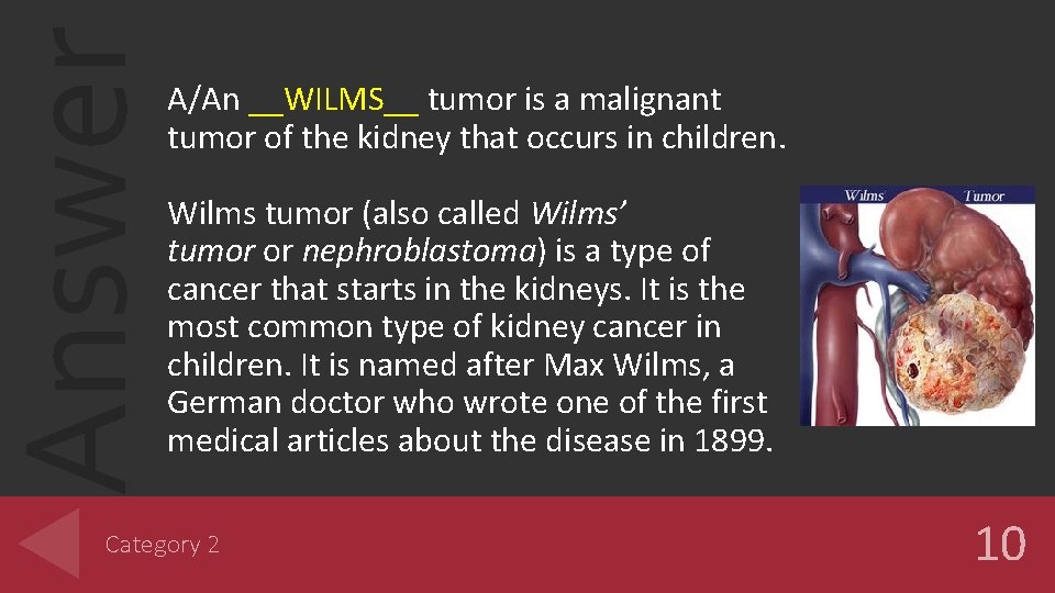 Answer A/An __WILMS__ tumor is a malignant tumor of the kidney that occurs in Answer A/An __WILMS__ tumor is a malignant tumor of the kidney that occurs in