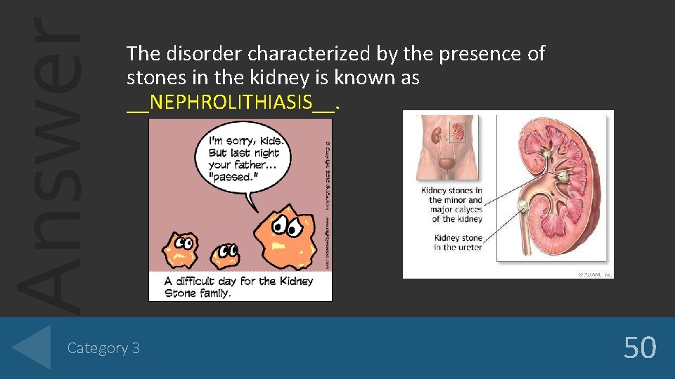 Answer The disorder characterized by the presence of stones in the kidney is known Answer The disorder characterized by the presence of stones in the kidney is known