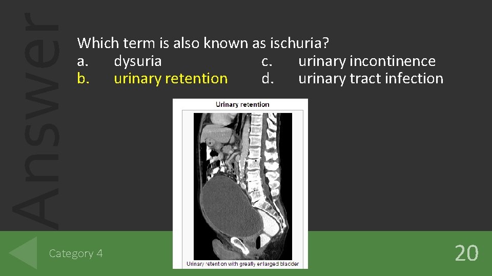 Answer Which term is also known as ischuria? a. dysuria c. urinary incontinence b. Answer Which term is also known as ischuria? a. dysuria c. urinary incontinence b.