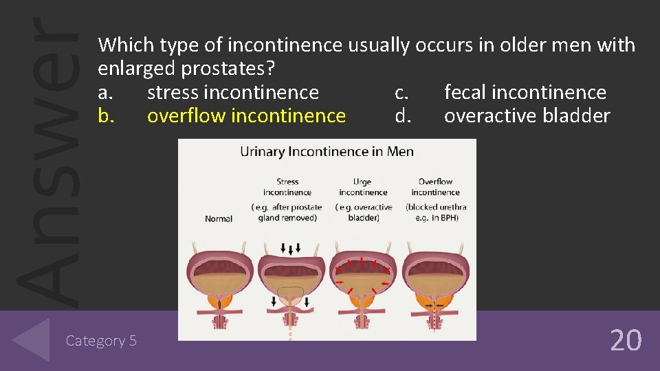 Answer Which type of incontinence usually occurs in older men with enlarged prostates? a. Answer Which type of incontinence usually occurs in older men with enlarged prostates? a.