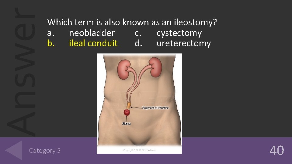 Answer Which term is also known as an ileostomy? a. neobladder c. cystectomy b. Answer Which term is also known as an ileostomy? a. neobladder c. cystectomy b.