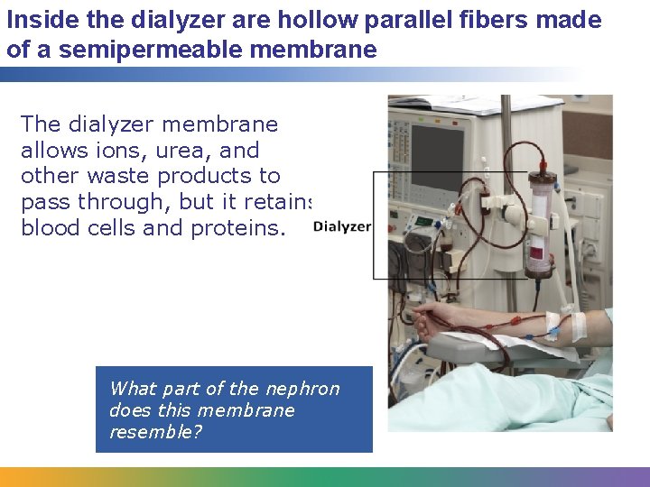Inside the dialyzer are hollow parallel fibers made of a semipermeable membrane The dialyzer