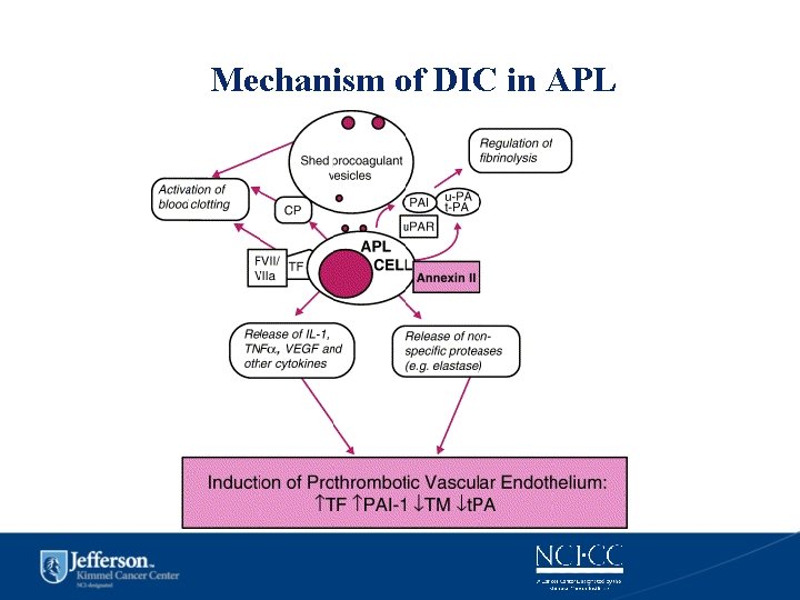 Mechanism of DIC in APL 