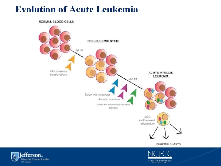 Evolution of Acute Leukemia 