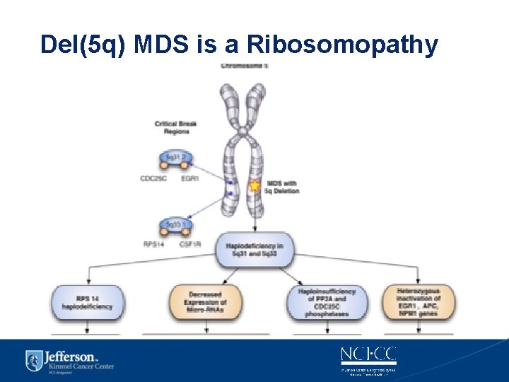 Del(5 q) MDS is a Ribosomopathy 