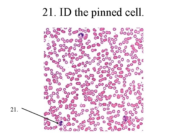 21. ID the pinned cell. 21. 