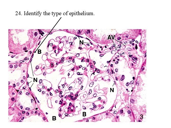 24. Identify the type of epithelium. 